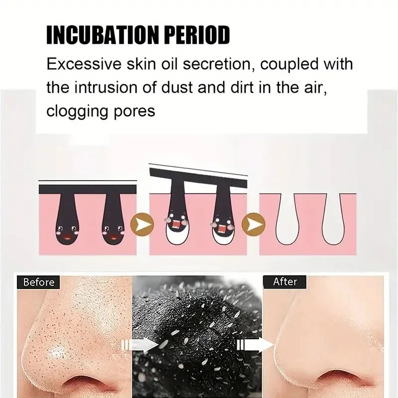 ClearSkin Nose Strips